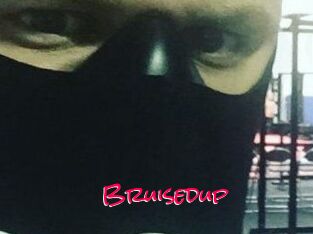 Bruisedup